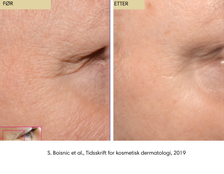 Romega® Skin Refine - kladd 13